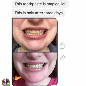 AP24 toothpaste :) my results!!!